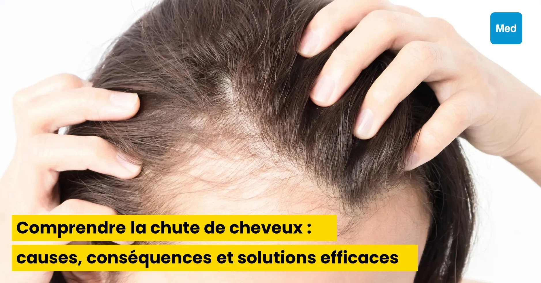 Comprendre la chute de cheveux : causes, conséquences et solutions efficaces